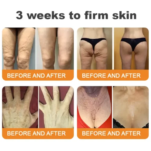 EQVP® Bee Venom Skin Restoration Cream