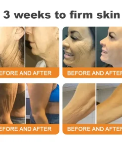 EQVP® Bee Venom Skin Restoration Cream