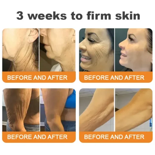 EQVP® Bee Venom Skin Restoration Cream